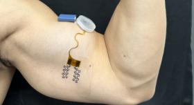 A man flexes his bicep, on which he wears a sensor made up of a small blue battery, a plastic cap, and an orange wire taped below the muscle.